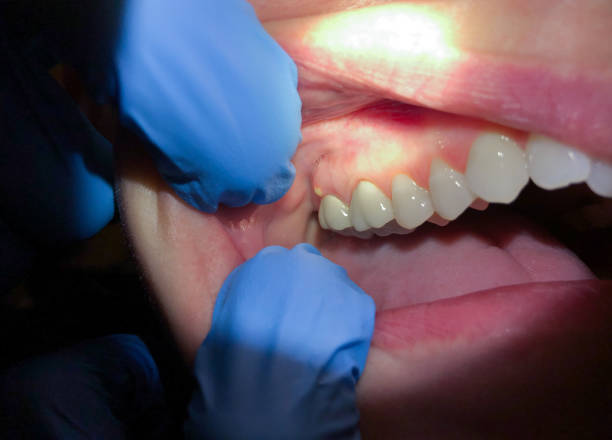 Best Weekend Emergency Dentist in Menonee, MI