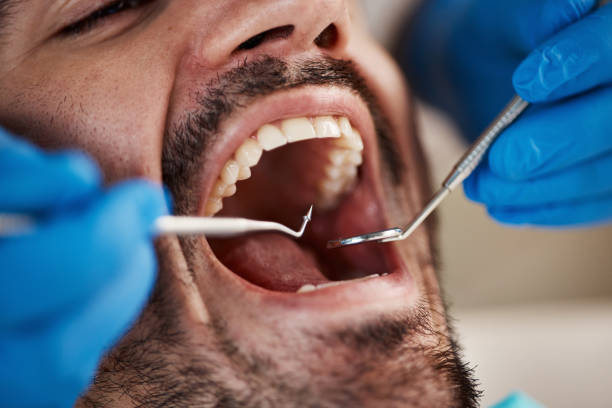 Best Emergency Broken Tooth Repair in Menonee, MI