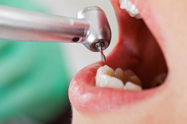Best Emergency Treatment for Toothache in Menonee, MI